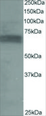 Anti-P70S6K/RPS6KB1 antibody produced in goat affinity isolated antibody, buffered aqueous solution