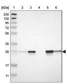 Anti-PRDX6 antibody produced in rabbit Prestige Antibodies&#174; Powered by Atlas Antibodies, affinity isolated antibody, buffered aqueous glycerol solution