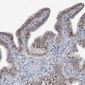 Anti-UCK1 antibody produced in rabbit Prestige Antibodies&#174; Powered by Atlas Antibodies, affinity isolated antibody, buffered aqueous glycerol solution