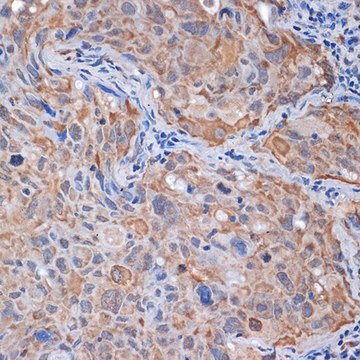 Anti-PP2A alpha + beta antibody produced in rabbit