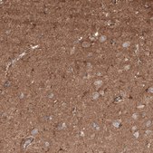 Anti-NRP2 antibody produced in rabbit Prestige Antibodies&#174; Powered by Atlas Antibodies, affinity isolated antibody, buffered aqueous glycerol solution