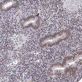 Anti-HNRNPA0 antibody produced in rabbit Prestige Antibodies&#174; Powered by Atlas Antibodies, affinity isolated antibody