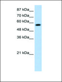Anti-KEAP1 (AB1) antibody produced in rabbit affinity isolated antibody