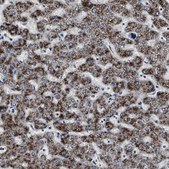 Anti-ACAA1 antibody produced in rabbit Ab2, Prestige Antibodies&#174; Powered by Atlas Antibodies, affinity isolated antibody, buffered aqueous glycerol solution