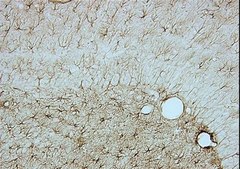 Anti-Glial Fibrillary Acidic Protein Antibody, clone GA5 clone GA5, Chemicon&#174;, from mouse