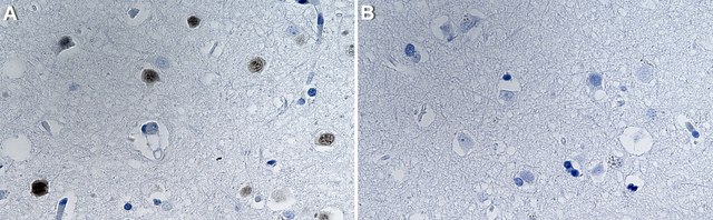 Anti-TBR1 Antibody, clone 1D16 ZooMAb&#174; Rabbit Monoclonal recombinant, expressed in HEK 293 cells