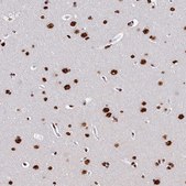 Anti-SRRM2 antibody produced in rabbit Prestige Antibodies&#174; Powered by Atlas Antibodies, affinity isolated antibody, buffered aqueous glycerol solution