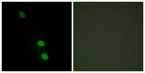 Anti-TEAD2 antibody produced in rabbit affinity isolated antibody