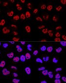 Anti-p53 antibody produced in rabbit