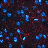 Anti-BACE1 antibody produced in rabbit affinity isolated antibody