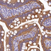 Anti-EPS8L2 antibody produced in rabbit Prestige Antibodies&#174; Powered by Atlas Antibodies, affinity isolated antibody, buffered aqueous glycerol solution