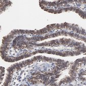 Anti-CHM antibody produced in rabbit Prestige Antibodies&#174; Powered by Atlas Antibodies, affinity isolated antibody, buffered aqueous glycerol solution