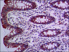 Anti-NOX1 (N-terminal) antibody produced in rabbit ~1.5&#160;mg/mL, affinity isolated antibody