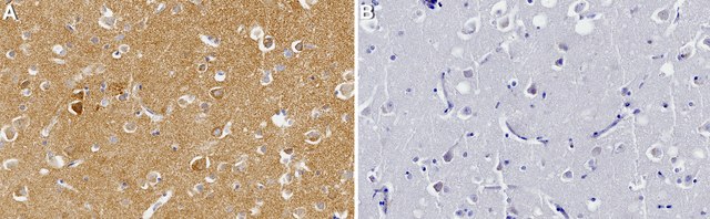 Anti-NF1 Antibody, clone 2N2 ZooMAb&#174; Rabbit Monoclonal recombinant, expressed in HEK 293 cells