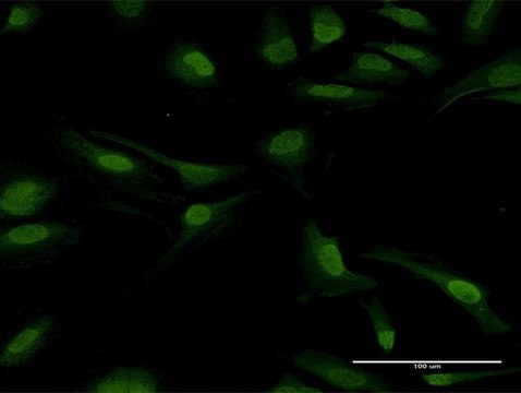 Anti-PPP2CB antibody produced in mouse purified immunoglobulin, buffered aqueous solution