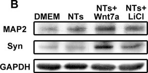 Anti-Microtubule-Associated Protein 2 (MAP2) Antibody Chemicon&#174;, from rabbit