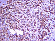 Anti-Integrin &#945;4 Antibody, clone P1H4, azide free clone P1H4, Chemicon&#174;, from mouse