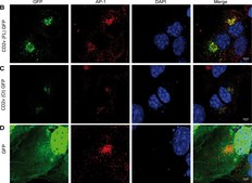 Monoclonal Anti-&#947;-Adaptin antibody produced in mouse clone 100/3, ascites fluid