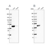Anti-ACAT1 antibody produced in rabbit Prestige Antibodies&#174; Powered by Atlas Antibodies, affinity isolated antibody, buffered aqueous glycerol solution