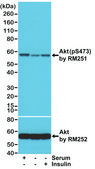 Anti-Phospho-akt (ser473) antibody, Rabbit monoclonal recombinant, expressed in HEK 293 cells, clone RM251, purified immunoglobulin