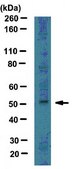 Anti-LMX-1 Antibody serum, from rabbit
