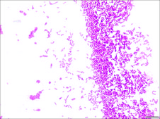Crystal Violet Solution