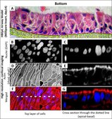 Human Bronchial Epithelial Cells: HBEpC, adult