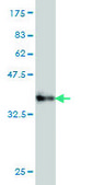 Monoclonal Anti-PPP3CB antibody produced in mouse clone 5D3, purified immunoglobulin, buffered aqueous solution