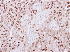 Anti-KDM6A antibody produced in rabbit