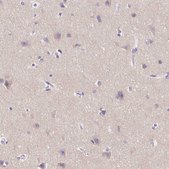 Anti-SSTR4 antibody produced in rabbit Prestige Antibodies® Powered by Atlas Antibodies, affinity isolated antibody, buffered aqueous glycerol solution