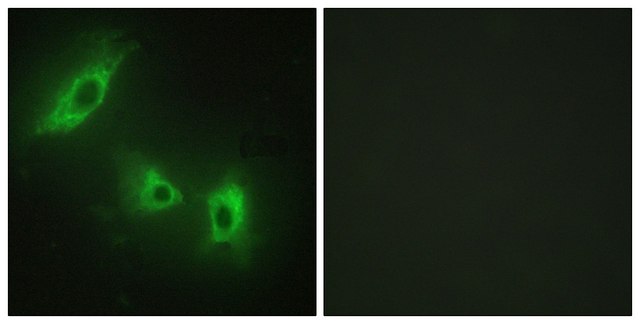Anti-ACV1B antibody produced in rabbit affinity isolated antibody