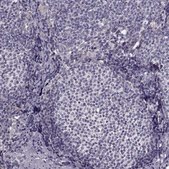 Anti-GHR antibody produced in rabbit Prestige Antibodies&#174; Powered by Atlas Antibodies, affinity isolated antibody