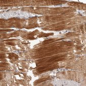 Anti-MRPS10 antibody produced in rabbit Prestige Antibodies&#174; Powered by Atlas Antibodies, affinity isolated antibody, buffered aqueous glycerol solution, ab1