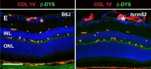 Anti-Collagen Antibody, Type IV Chemicon&#174;, from rabbit