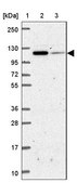Anti-IDE antibody produced in rabbit Prestige Antibodies&#174; Powered by Atlas Antibodies, affinity isolated antibody, buffered aqueous glycerol solution