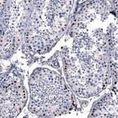 Monoclonal Anti-SALL4 antibody produced in mouse Prestige Antibodies® Powered by Atlas Antibodies, clone CL12180, purified immunoglobulin, buffered aqueous glycerol solution