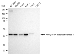 KD-Validated Anti Acetyl-CoA acetyltransferase 1 Antibody, clone 23GB1255, Rabbit Monoclonal clone 23GB1255, recombinant rabbit monoclonal, expressed in HEK293 cells