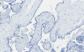 Anti-Integrin β3 Antibody, clone EM00212 ZooMAb® Rabbit Monoclonal recombinant, expressed in HEK 293 cells