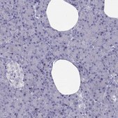 Anti-TRPM7 antibody produced in rabbit Prestige Antibodies&#174; Powered by Atlas Antibodies, affinity isolated antibody