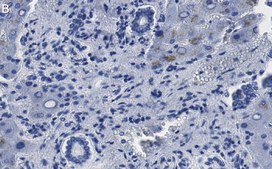 Anti-MeCP2 Antibody, clone 1L20 ZooMAb® Rabbit Monoclonal recombinant, expressed in HEK 293 cells