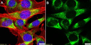 Anti-Tropomyosin Antibody, clone 1C5 ZooMAb&#174; Rabbit Monoclonal recombinant, expressed in HEK 293 cells