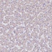 Anti-PGAM2 antibody produced in rabbit Prestige Antibodies&#174; Powered by Atlas Antibodies, affinity isolated antibody, buffered aqueous glycerol solution