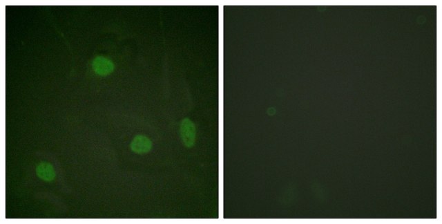 Anti-Histone H3 (Acetyl-Lys23) antibody produced in rabbit affinity isolated antibody