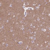 Anti-SYN1 antibody produced in rabbit Prestige Antibodies&#174; Powered by Atlas Antibodies, affinity isolated antibody, buffered aqueous glycerol solution
