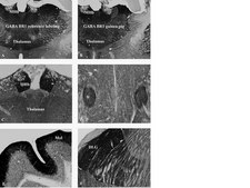 Anti-GABA B Receptor R1 Antibody serum, from guinea pig
