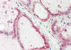 Anti-ATE1 antibody produced in rabbit affinity isolated antibody