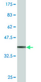 Monoclonal Anti-CBS, (N-terminal) antibody produced in mouse clone 6B8, purified immunoglobulin, buffered aqueous solution