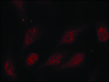 Anti-phospho-TP53 (pSer315) antibody produced in rabbit affinity isolated antibody