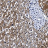Anti-ADH4 antibody produced in rabbit Prestige Antibodies&#174; Powered by Atlas Antibodies, affinity isolated antibody, buffered aqueous glycerol solution