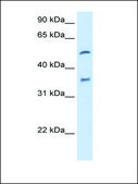 Anti-CYP2D6 antibody produced in rabbit IgG fraction of antiserum